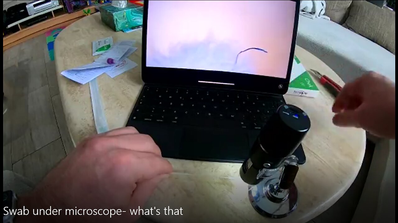 Swab under microscope- what's that?