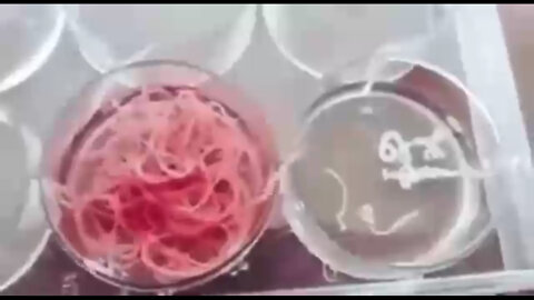 LOS PARÁSITOS SE TOMAN DE UN HOMBRE VACUNADO CON TRES DOSIS DE PFIZER.