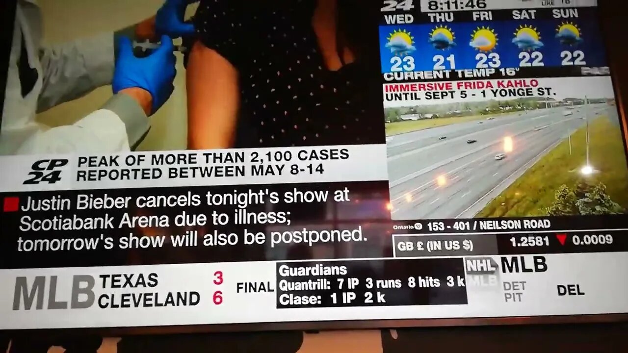 PANIC!!!! 🐒 😷 POX AND THE NORMAL FLU IS HERE🤣🤣🤣🤣 CP24 News Says