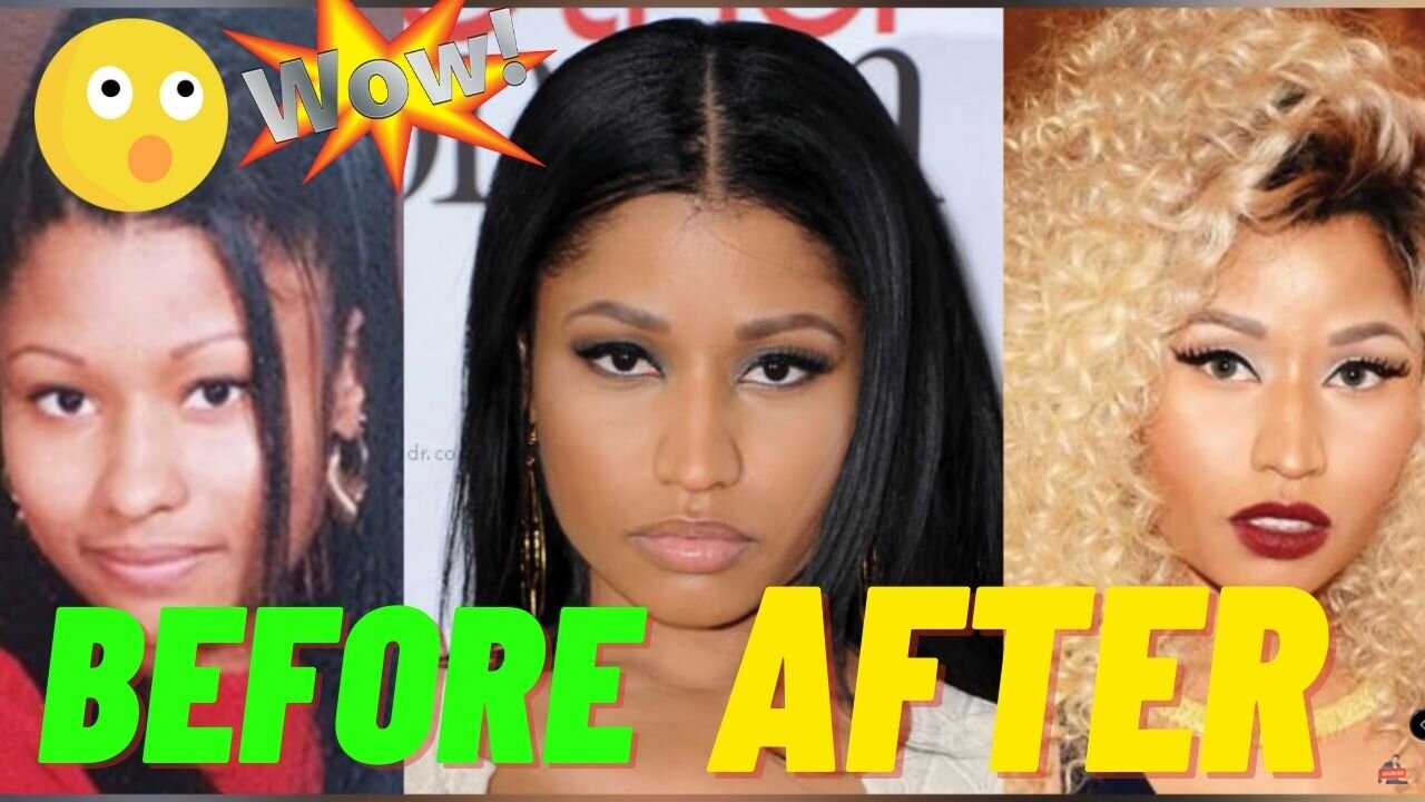 Amazing!! NICKI MINAJ | Before & After Transformation [ Plastic Surgery, Makeup & More ]