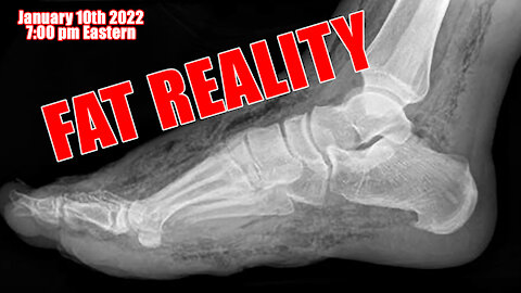 Fat Reality | The Dangers of Obesity | Warning Graphic Content | Live 1/10/22 7 p.m.