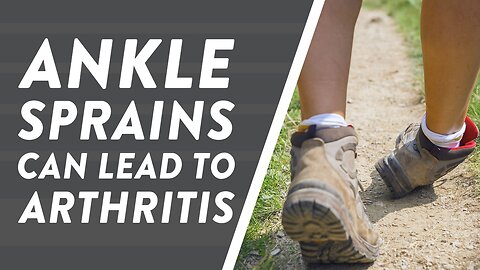 Ankle sprains can lead to arthritis