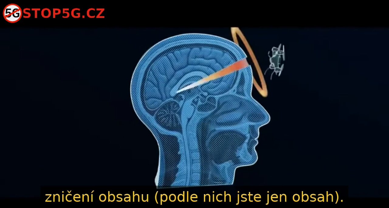 Na Ovládání Lidí není Potřeba Čip - 5G Fázované Anténní Pole jako Smrtící Radar