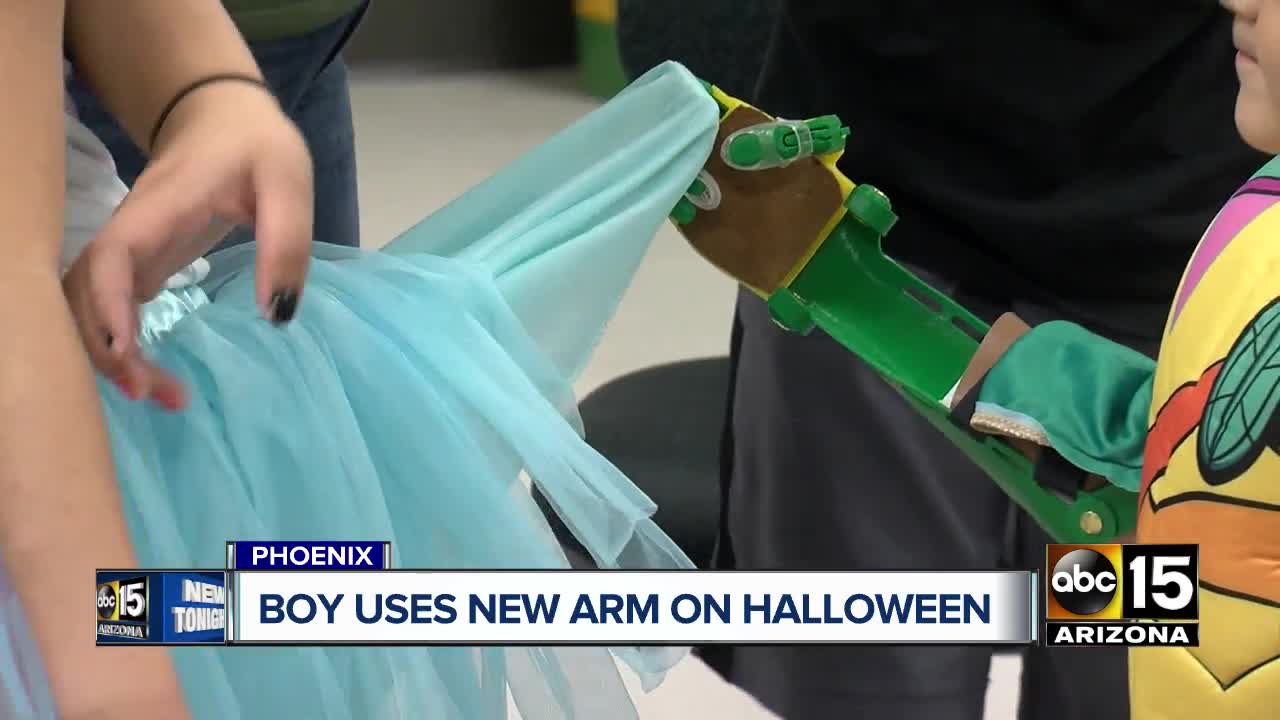 Boy uses new prosthetic arm on Halloween