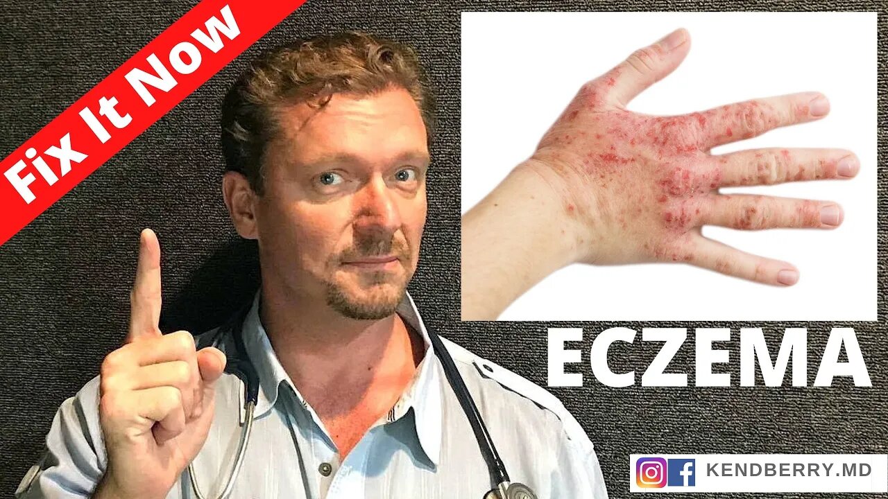 ECZEMA (Improve or Reverse Your Eczema NOW) 2021