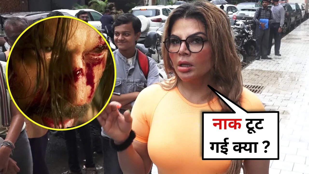 Rakhi Sawant UNEXPECTED Reaction On Shah Rukh Khan Injures Nose On Set