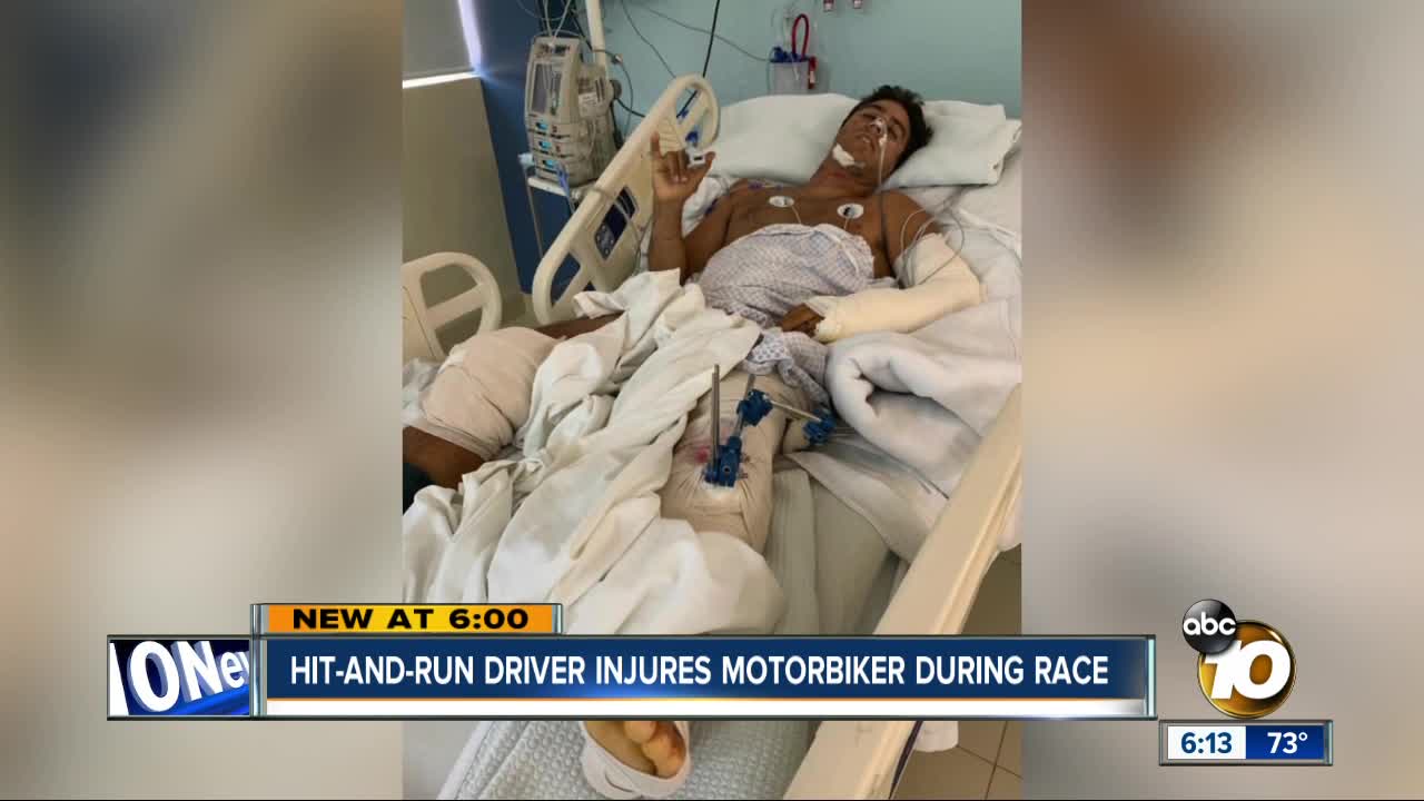 Hit-and-run driver injures San Diego biker in Mexico