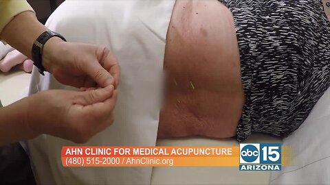 We found the solution for lower back pain: The Ahn Clinic for Medical Acupuncture