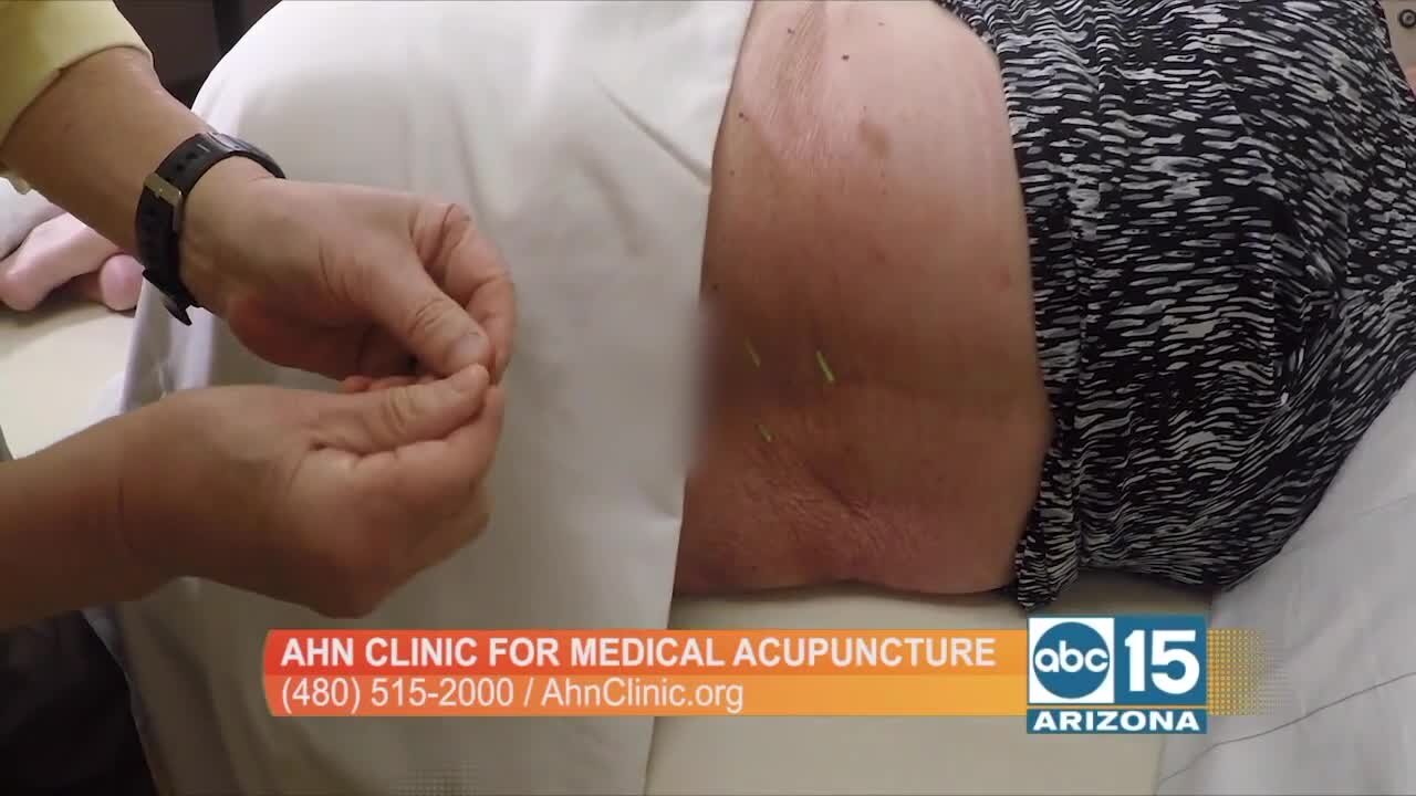 We found the solution for lower back pain: The Ahn Clinic for Medical Acupuncture