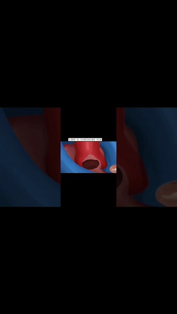 ASMR || Coronary bypass valve Repair ||Graft Surgery #shorts