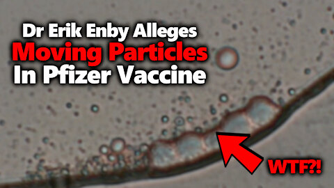 Dr. Erik Enby Presents His Pfizer Vaccine Microscopy Analysis In A Fascinating Interview