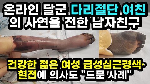 [#507] 온라인 달군 다리절단 여친의 사연을 전한 남자친구 - 건강한 젊은 여성 급성심근경색·혈전에 의사도 드문 사례