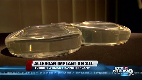 Tucson woman is part of the worldwide recall on Allergan breast implants