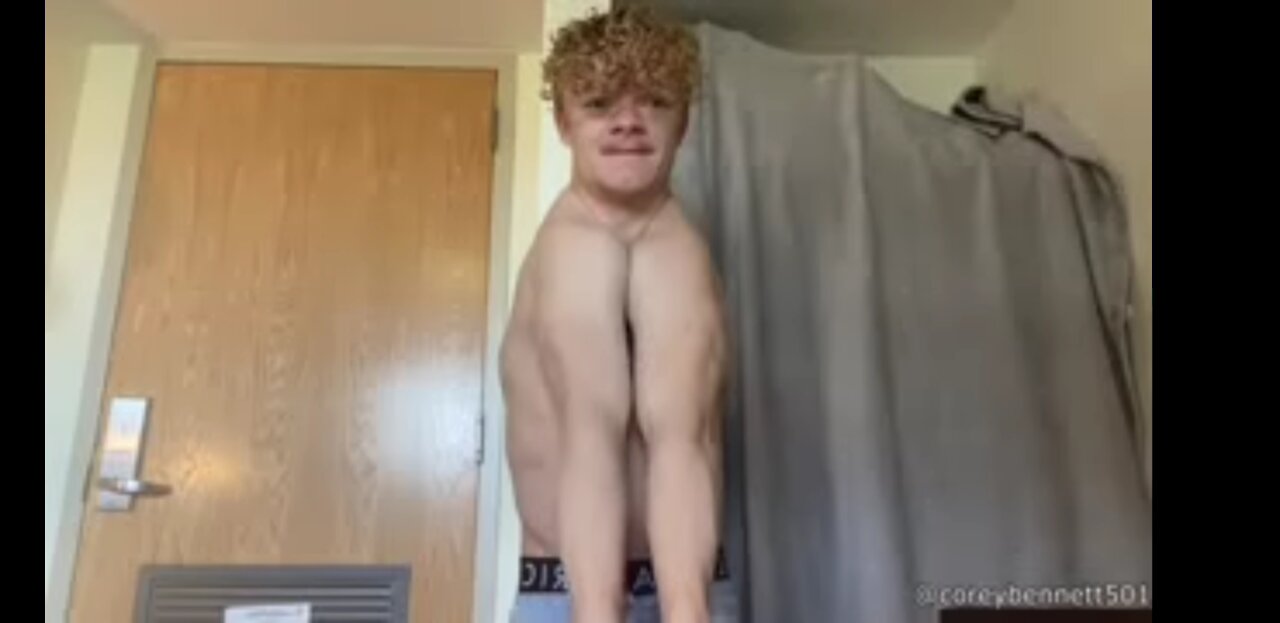 Man Born Without a Collarbone 2021