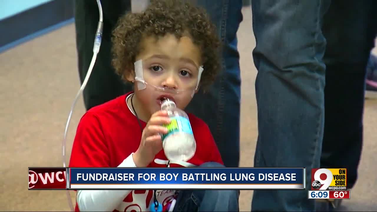 Fundraiser for 5-year-old battling lung disease