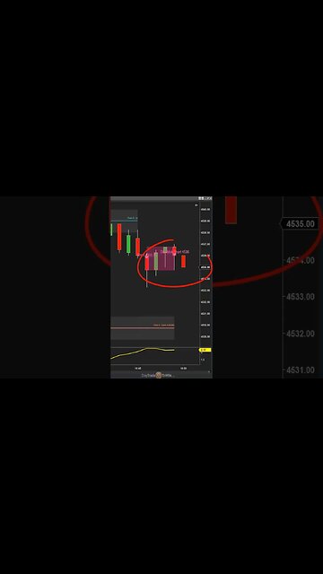 Traders Learn to Master ⚜️ Day Trading Success #daytradetowin #stockmarket #daytrading