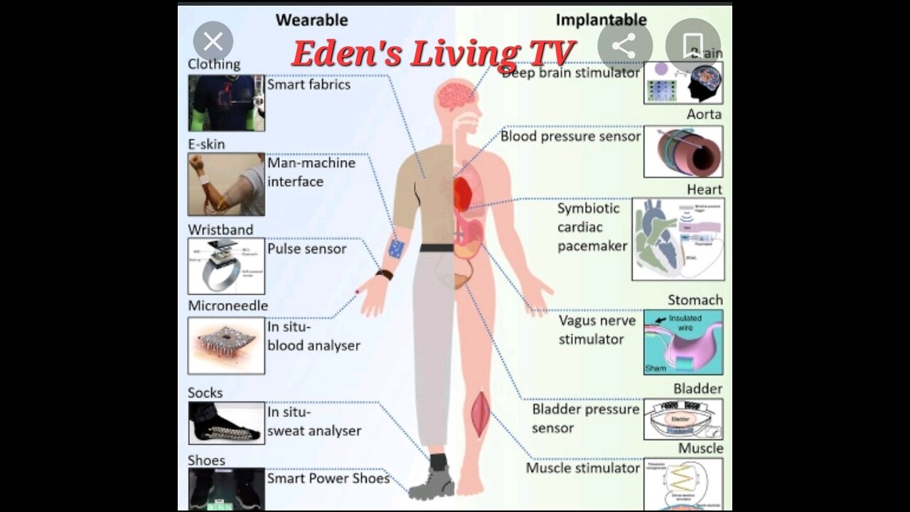 Wearable vs Implant