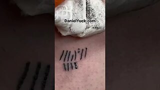 Blown Out Skin