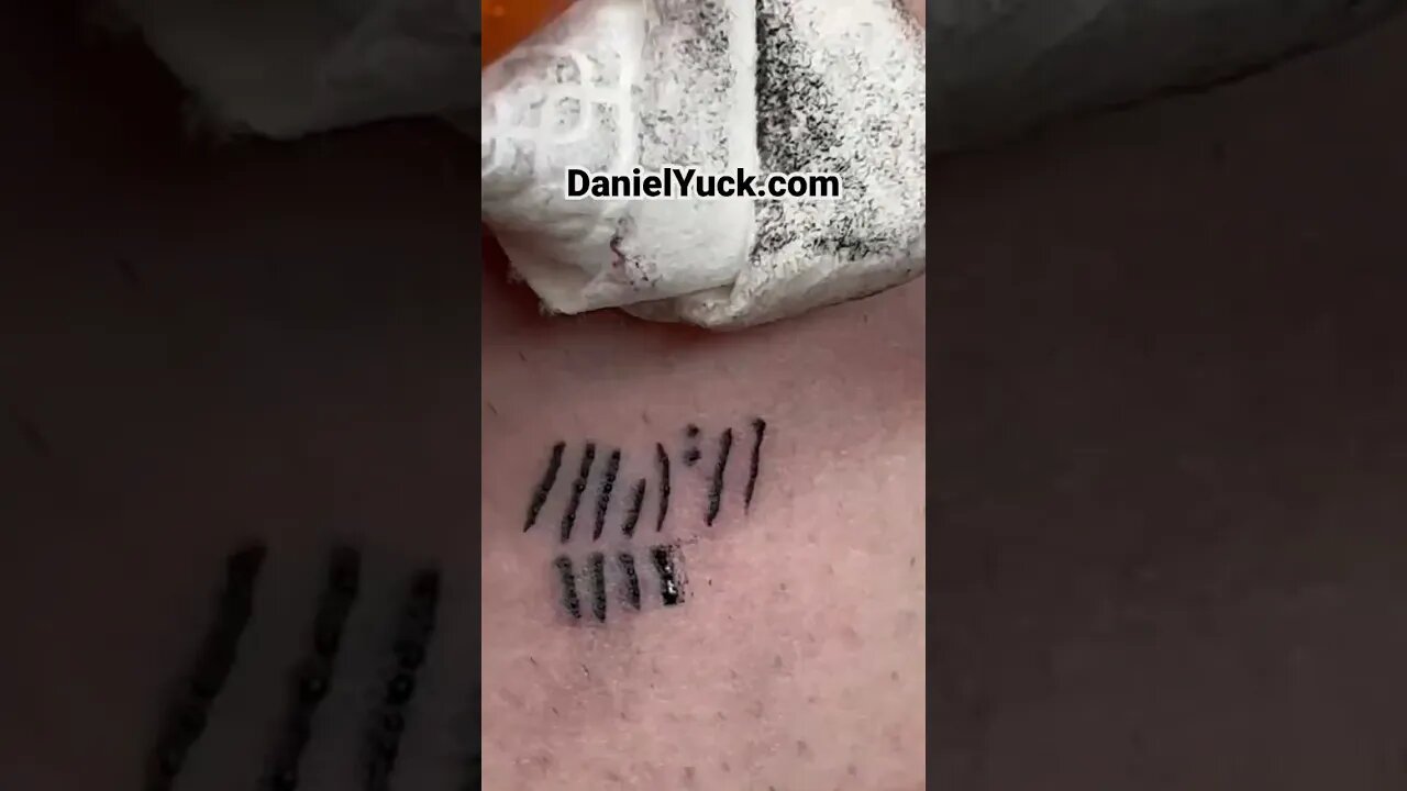 Blown Out Skin