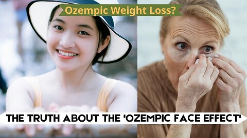 Danger! Ozempic Weight Loss & The Shocking "Ozempic Face Effect"