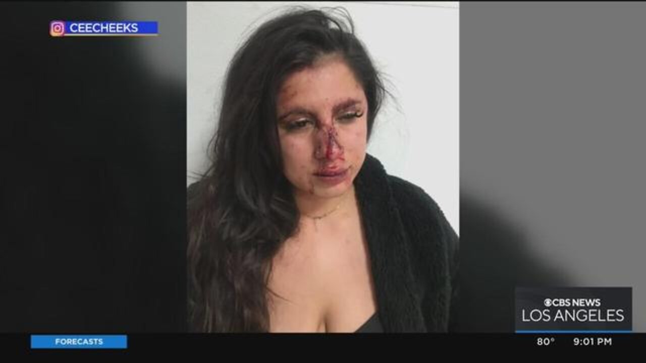 Woman violently beaten by multiple men in Hollywood parking garage