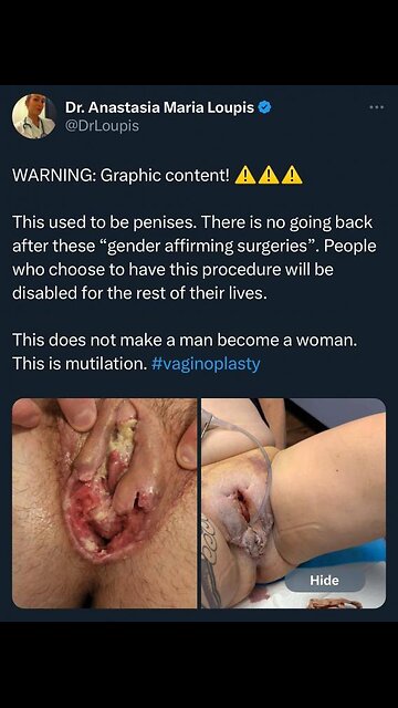 democrat Tim Walz's Lt Gov Peggy Flanagan push transgender lgbt mutilation surgery on innocent kids