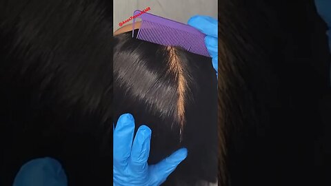 Scalp Check & Treatment ~ASMR No Talking #asmr #asmrsounds #anon7mousasmr #shorts