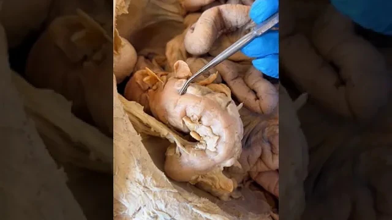 How Crazy Is This??