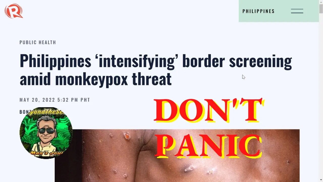 Don't Panic: It's Just MonkeyPox