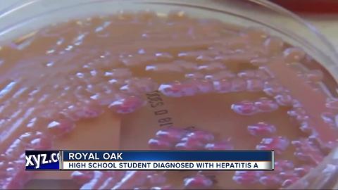 Student at Royal Oak High School diagnosed with hepatitis A