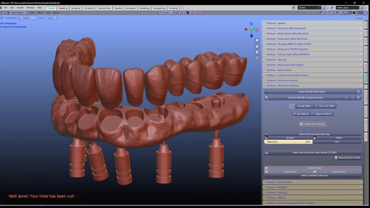 Making a hybrid for the tissue, separated teeth.