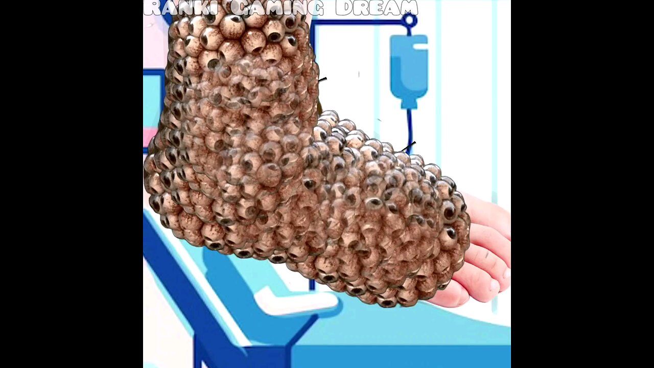 ASMR Animation trypophobia Deep cleaning big surgery foot| ASMR animation treatments