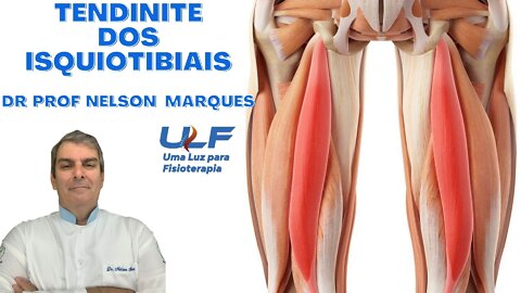 TENDINITE DE ISQUIOTIBIAIS - Dr. Prof. Nelson Marques