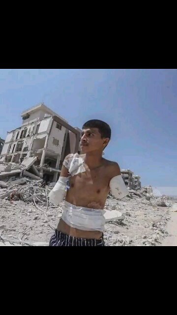 You don't know what it feels like without arms. GAZA PALESTINE