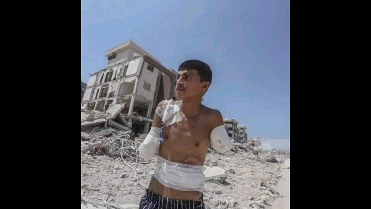 You don't know what it feels like without arms. GAZA PALESTINE