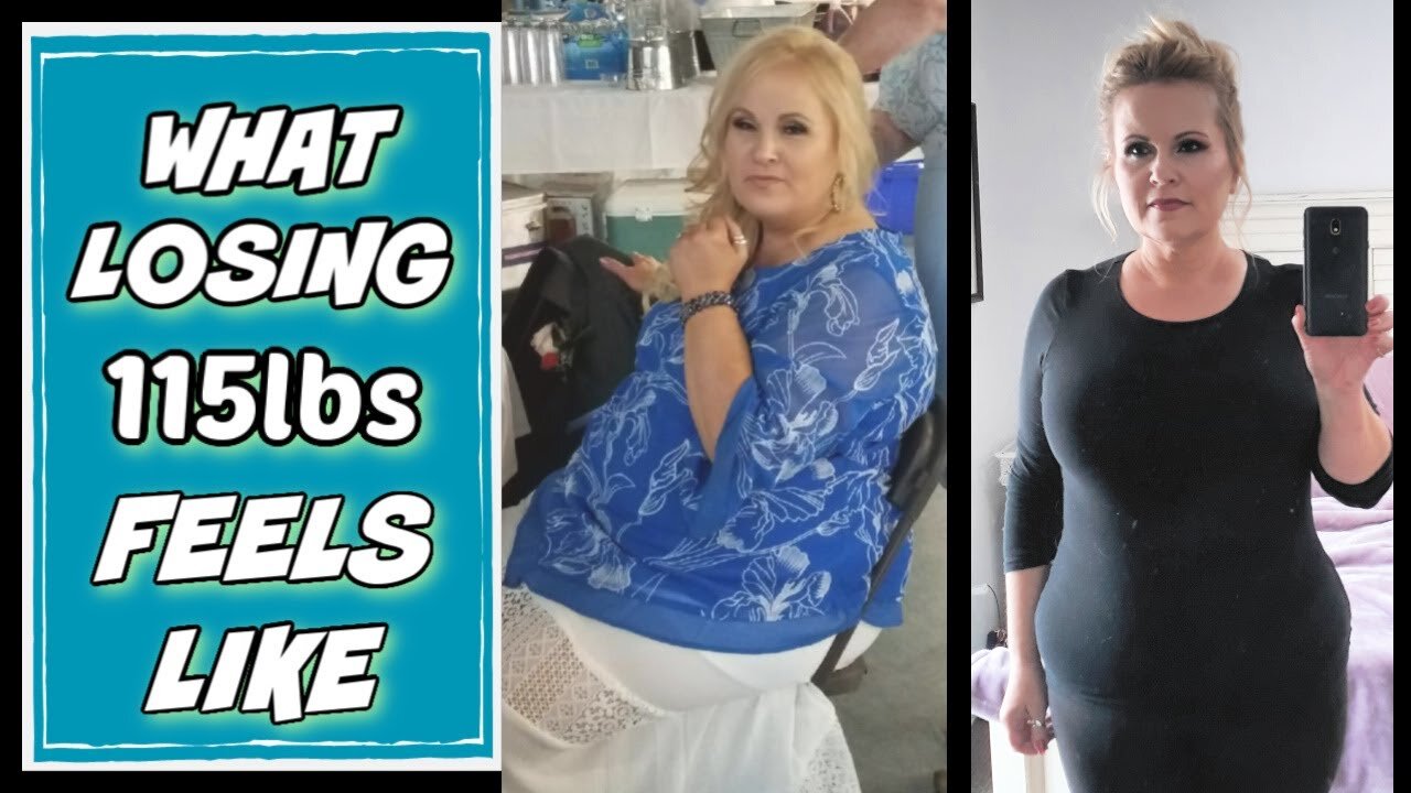 I LOST 115 Pounds WITH WEIGHT LOSS SURGERY | Over 50 | RNY| Gastric Bypass