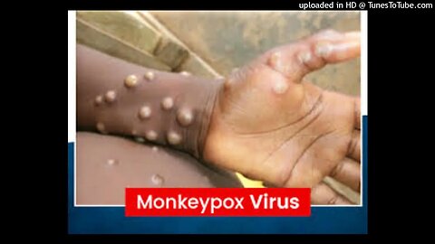 MONKEYPOX NEWS: HOW TO KEEP YOUR LOVED ONES SAFE! #MONKEYPOX