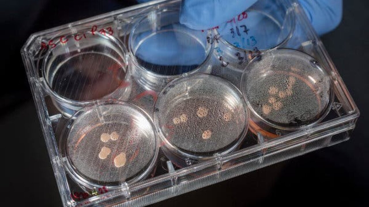 What Are Organoids? - Welcome to the Transhumanist AI Revolution