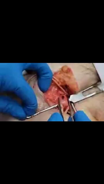 THE DEAD CLOTSHOT EXAM TABLE