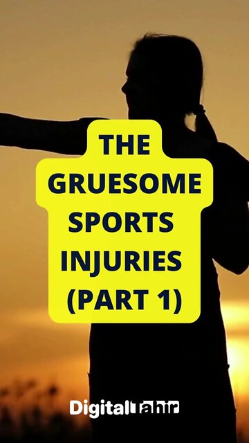 PART 1: Top 10 Gruesome Sports Injuries #shorts