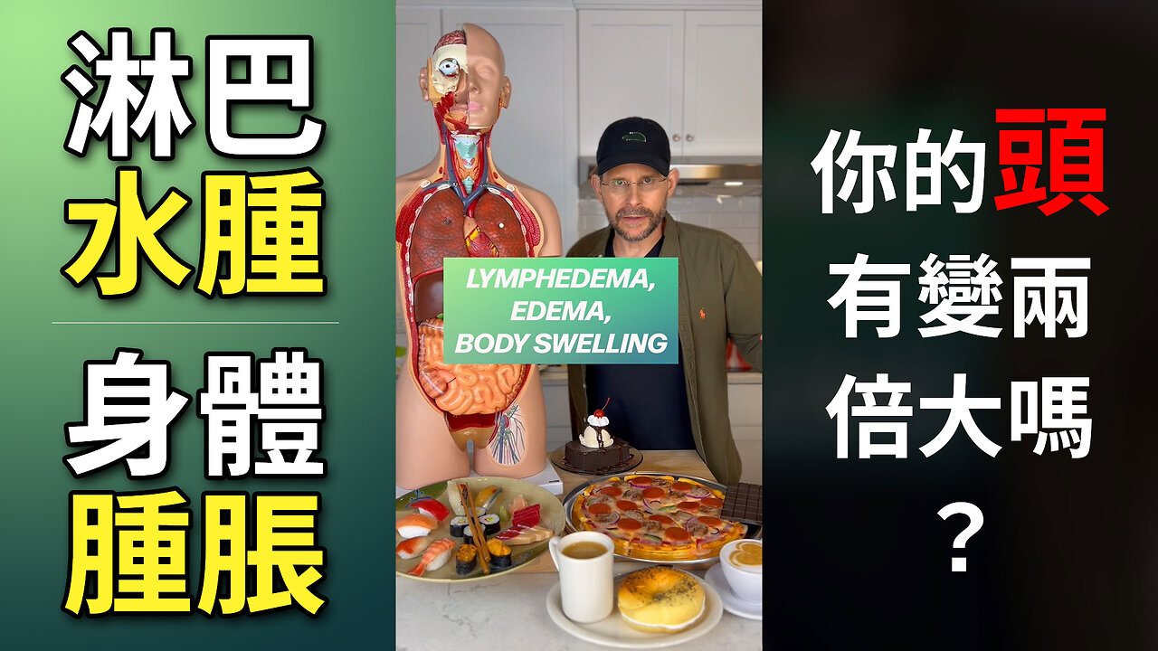 你的胖其實不是胖 Lymphedema, Edema, Body Swelling