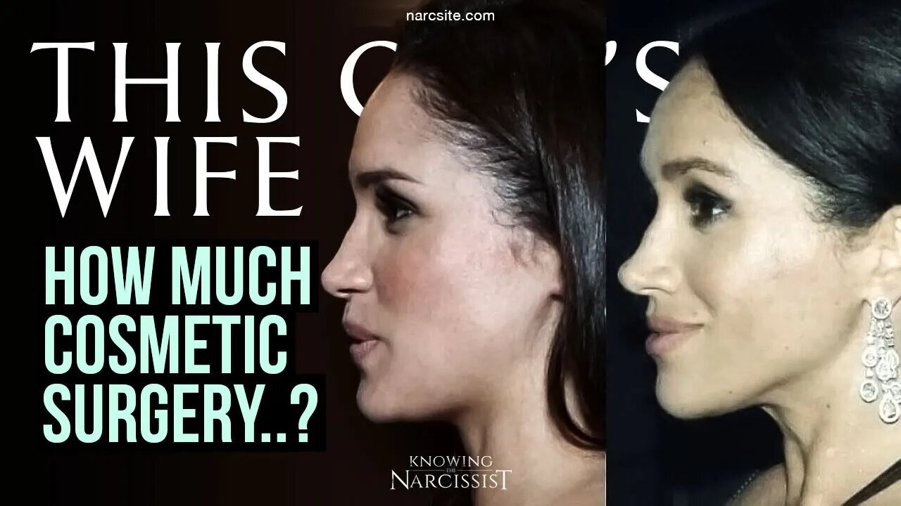 How Much Cosmetic Surgery? (Meghan Markle)