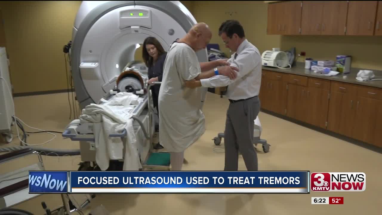 Focused ultrasound used to treat tremors