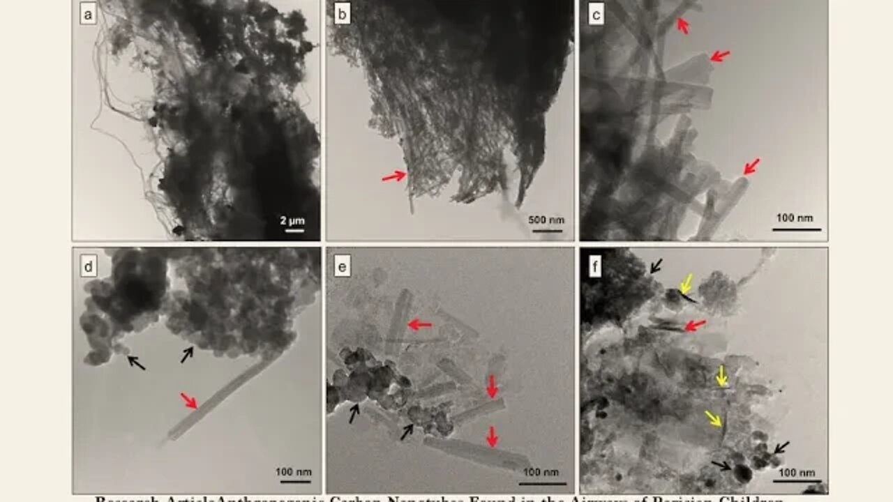 Scientists Find Carbon Nano Tubes In Lungs Of Everyone Tested & Possibly All Biological Life, Latest