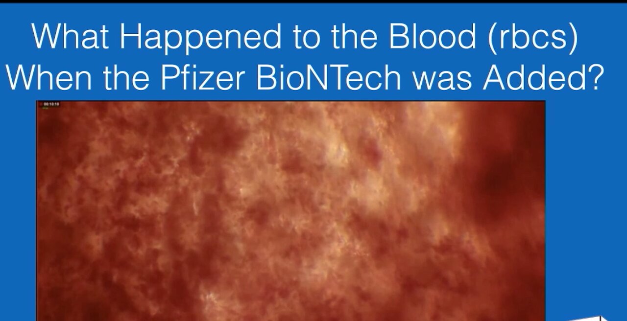 WHAT HAPPENS TO YOUR BLOOD AFTER A PFIZER INJECTION? THIS IS OUTRAGEOUS!!!