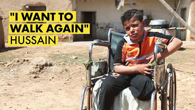 A Syrian boy’s story after a landmine explosion