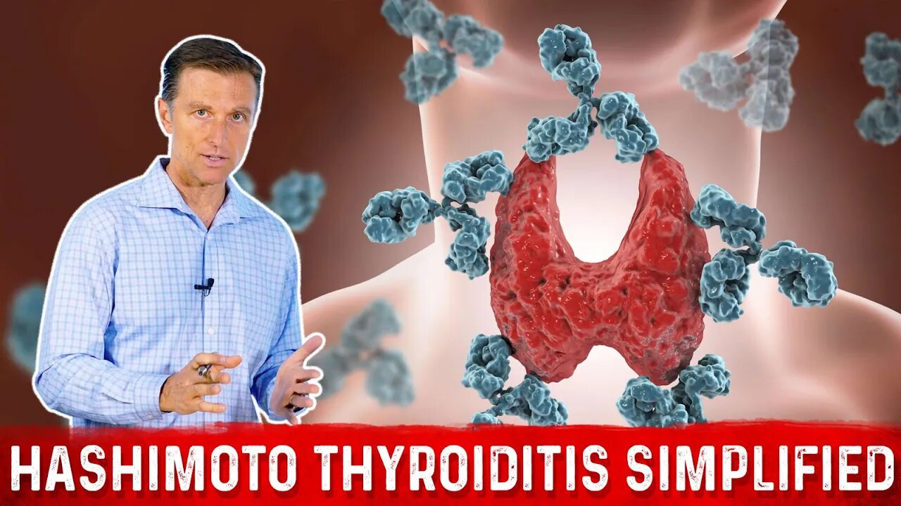 Hashimoto Thyroiditis (Autoimmune Hypothyroid) Simplified by Dr. Berg