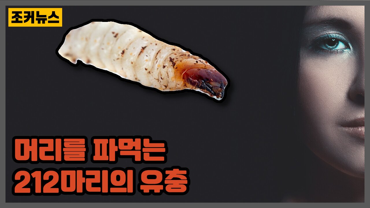 소녀의 머리를 파먹는 212마리의 유충 head-eating larvae -Joker News