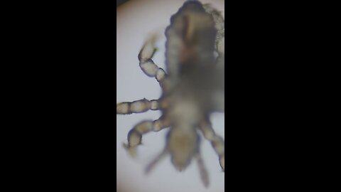 Lice under a microscope