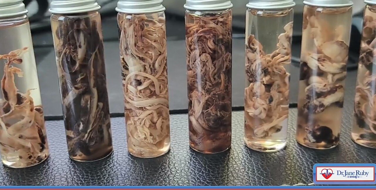 The "vaccine" Bioweapon